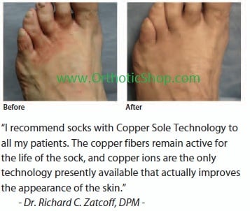 Copper Socks Before, After Picture